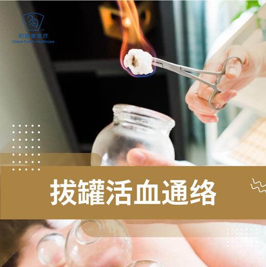 拔罐活血通络 商品图0