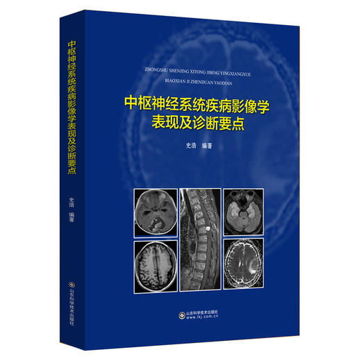 中枢神经系统疾病影像学表现及诊断要点 商品图0