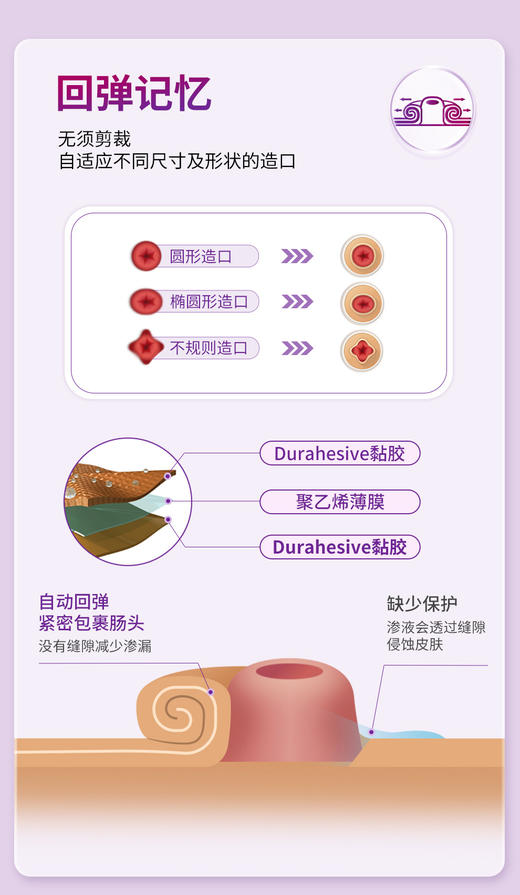 康维德舒洁可塑两件式耐用凸面造口袋底盘 免裁剪 404592/404593/404594 商品图6