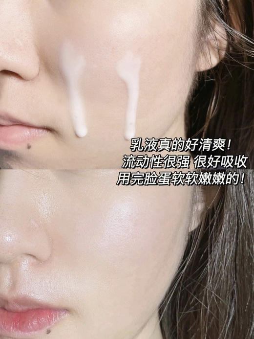 润熙泉玻尿酸青颜水乳护肤套盒 商品图1