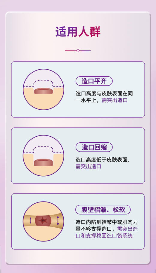 CONVATEC康维德两件式NATURA两件式耐用风琴裁剪式凸面底盘421638/421640/421642 商品图12