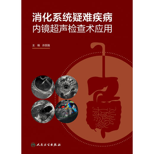【预售】消化系统疑难疾病内镜超声检查术应用 商品图1