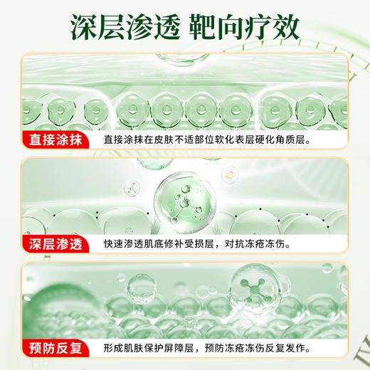 云南本草冻疮膏止痒冻伤膏护手霜防冻疮防裂消肿冻手儿童正品冬季 商品图4