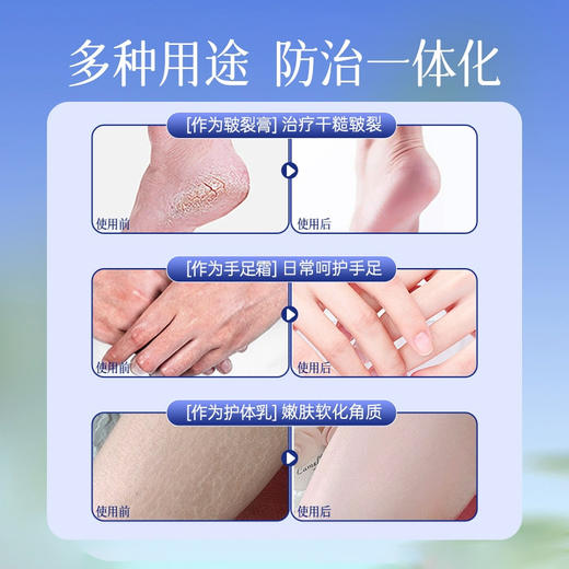 [防皲裂] 蛇油膏100G 滋润皮肤护肤日常保湿滋润防皲裂手足滋润锁水身体呵护 商品图2