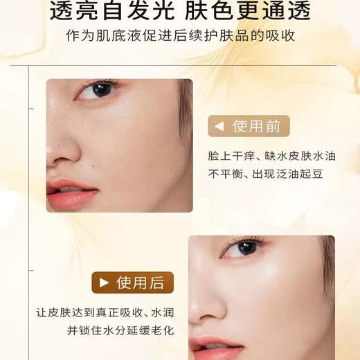 [ 明星都爱它] 新版台湾AUDAE奥达士 nywow o女娲oao兰花油 保润补水润养KAN皱修护保湿精华液 商品图9