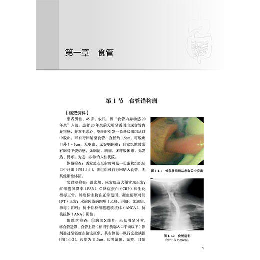 消化系统疑难疾病内镜超声检查术应用 许国强 适合消化内科消化内镜胃肠外科肝胆胰外科超声影像科医师等学习阅读 人民卫生出版社 商品图4
