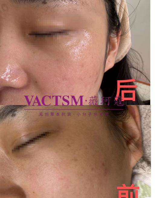 薇珂蔻-小分子水光液(5ml*6支) 精华液 商品图8