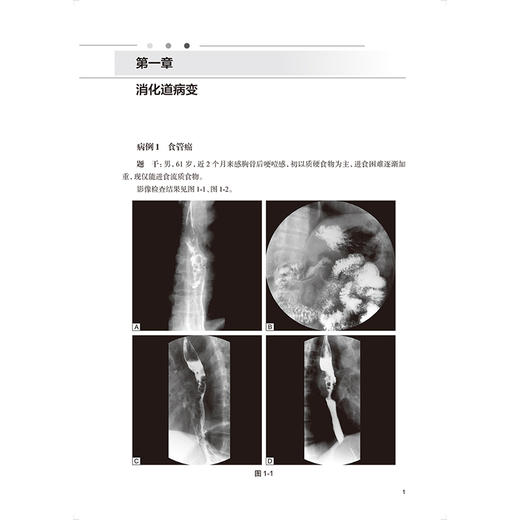 消化系统疾病放射影像诊断思维与决策 住院医师规范化培训结业临床实践能力考核题库 居胜红 赵心明 9787117384858人民卫生出版社 商品图4