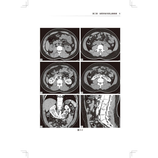 泌尿生殖疾病放射影像诊断思维与决策 住院医师规范化培训结业临床实践能力考核题库 张惠茅 张瑞平 主编 放射医学 人民卫生出版社 商品图4