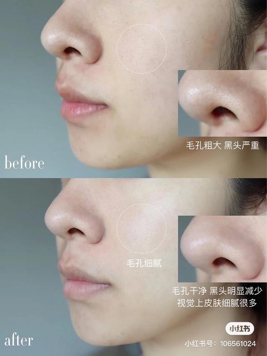 直发【27.6】 清洁面膜鼻祖级大佬 科颜氏白泥面膜125ml 商品图7