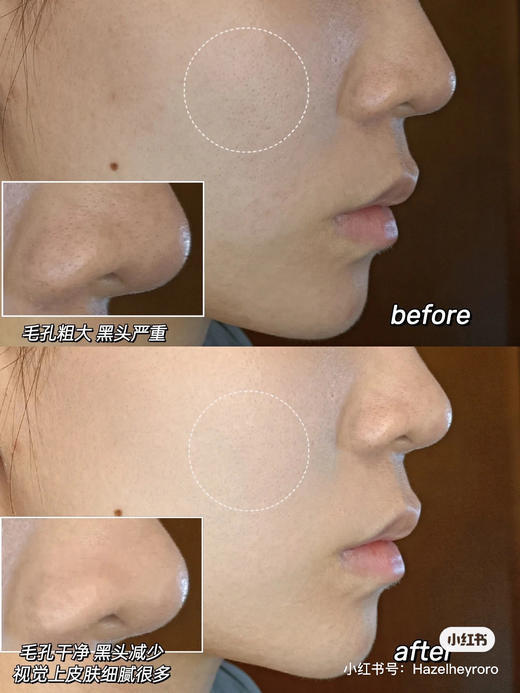 直发【27.6】 清洁面膜鼻祖级大佬 科颜氏白泥面膜125ml 商品图11