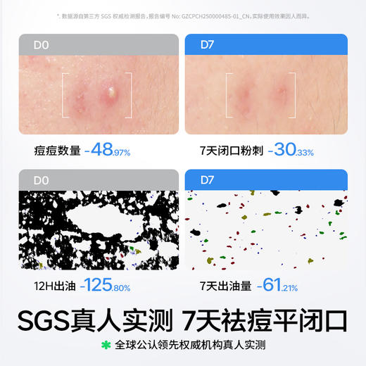 【品牌直供】【抗初痘系列】Hi!papa海龟爸爸双萃控油精华水 商品图4