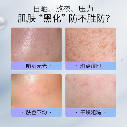 【老客专属福利】NACO烟酰胺星璨精华液1.5ml/支*28支/盒 高纯烟酰胺「发光瓶」   焕亮灯泡肌 商品图1