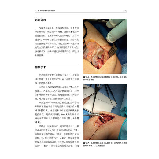 骨折翻修手术 李阳 税巍 唐颖 主译 本书系统地涵盖了骨折翻修手术的各个方面 从基础理论到临床实践等 辽宁科学技术出版社 商品图4