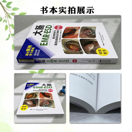 大肠EMRESD 通过病例学习最适合病变的治疗策略 修订版 唐秀芬 主译 消化科 消化内镜 临床医学 9787559132116辽宁科学技术出版社 商品图2