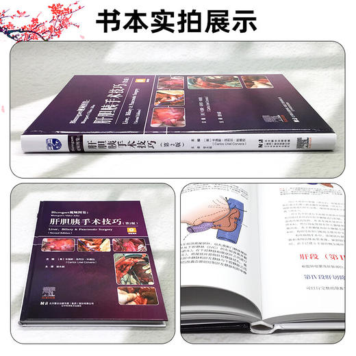 Blumgart视频图集 肝胆胰手术技巧第2二版 曾永毅 本手术视频图谱详细描述了肝脏 胆管和胰腺方面的手术技术等 辽宁科学技术出版社 商品图2