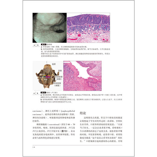 【出版社直发】胃与肠应该了解的口腔及咽喉病变 日本《胃与肠》编委会编著 自身免疫性胃炎 9787559141828 辽宁科学技术出版社 商品图4