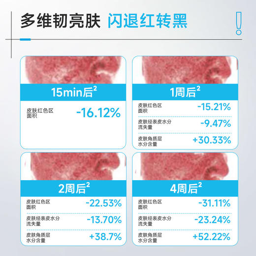 【🌟美白祛斑】绽妍 传明酸美白淡斑面膜 「国妆持证，更适合中国人肤质的美白面膜」 商品图2