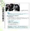 大肠EMRESD 通过病例学习最适合病变的治疗策略 修订版 唐秀芬 主译 消化科 消化内镜 临床医学 9787559132116辽宁科学技术出版社 商品缩略图4