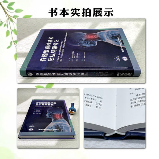 脊髓型颈椎病和后纵韧带骨化 曹凯 陈雄生 张雪松 主译 脊髓型颈椎病与后纵韧带骨化症的病理生理学 骨科学 辽宁科学技术出版社 商品图2