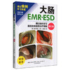 大肠EMRESD 通过病例学习最适合病变的治疗策略 修订版 唐秀芬 主译 消化科 消化内镜 临床医学 9787559132116辽宁科学技术出版社 商品缩略图1