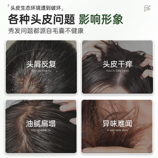 百年扁氏艾草止痒头皮洗发水 商品图1