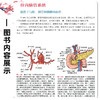 Blumgart视频图集 肝胆胰手术技巧第2二版 曾永毅 本手术视频图谱详细描述了肝脏 胆管和胰腺方面的手术技术等 辽宁科学技术出版社 商品缩略图4