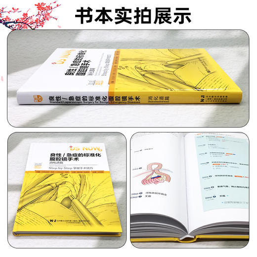 良性/急症的标准化腹腔镜手术：消化道篇 掌握手术技巧 附视频 王利明 主译 消化外科学 9787559141248 辽宁科学技术出版社 商品图2