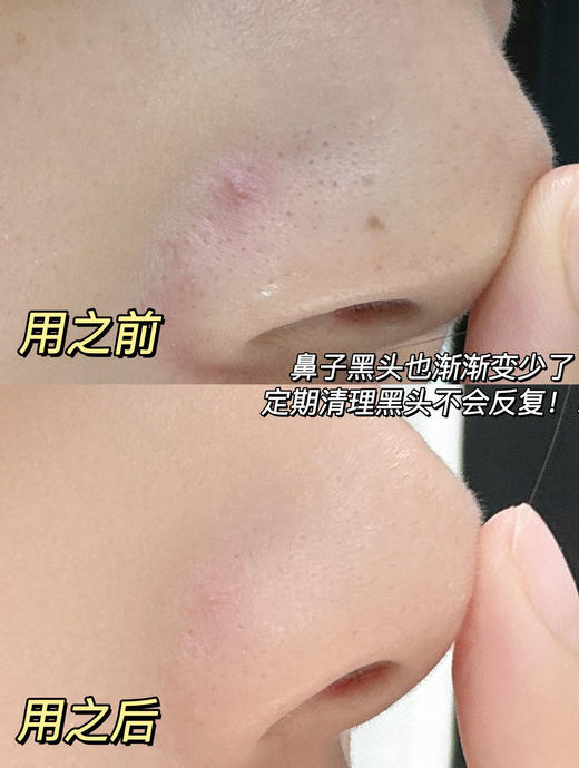 【到手两瓶】润熙泉清洁泥膜浅釉净澈泥膜110g/瓶 商品图5