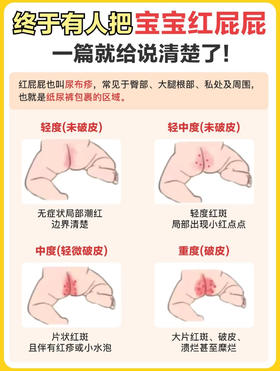 小屁屁保卫战：预防尿布疹，远离红屁屁！