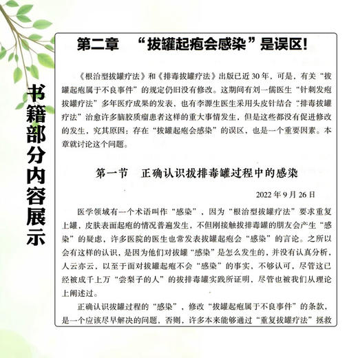 重复拔罐疗法 根治型排毒拔罐疗法详解 李志锐 吴娟 于洪名 王佳栋 主编 医学书籍 中医 9787559144850 辽宁科学技术出版社 商品图4