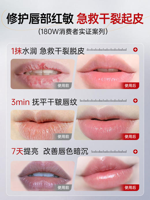 【KO干裂起皮 水润保湿】润唇膏女保湿滋润补水防干裂去死皮淡化唇纹唇炎官方旗舰店正品男 商品图2