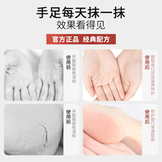 丁教授蛇油膏防冻防裂呵护手足  厂家直发 商品图3