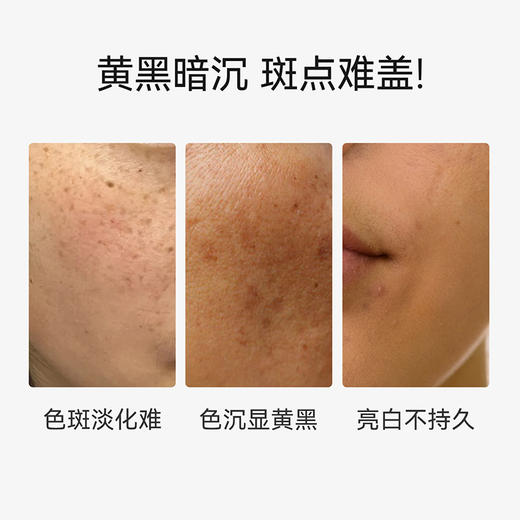 （小眠专属）春日来信美白雪肌面霜 | 净斑焕白，多维抑黑【品牌直发】 商品图2