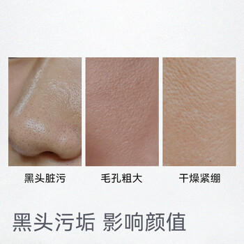 京东京造亚马逊白泥净致清洁面膜135g清洁泥膜补水收缩毛孔护肤男女士专用 商品图3