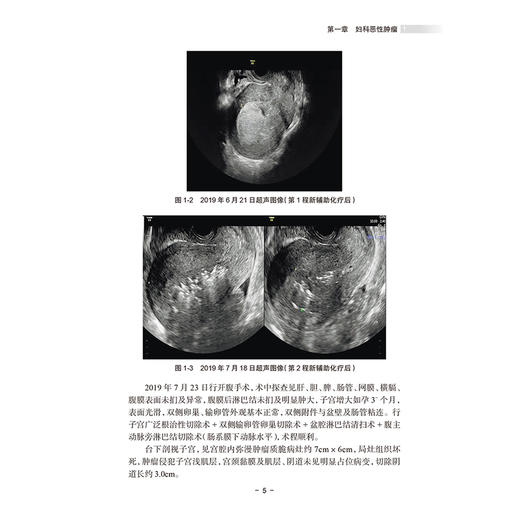 妇科肿瘤多学科综合诊疗医案精选 肖静 孙艳梅 适合广大妇科医师、医学院校师生及其他相关医学专业人士参考阅读 人民卫生出版社 商品图4