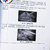 肝胆胰疾病诊疗新技术**护理 商品缩略图4
