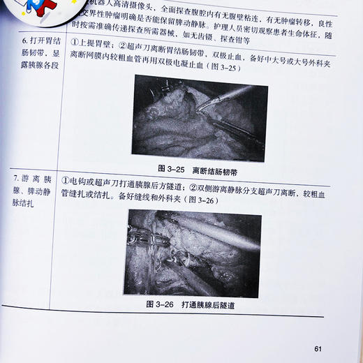 肝胆胰疾病诊疗新技术**护理 商品图4