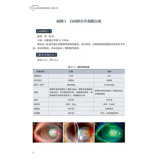 中山晶状体病病例解析 2025版（中山眼科疑难眼病系列）罗莉霞 谈旭华 附赠43个高清视频 西医 眼科学9787117388948人民卫生出版社 商品图4