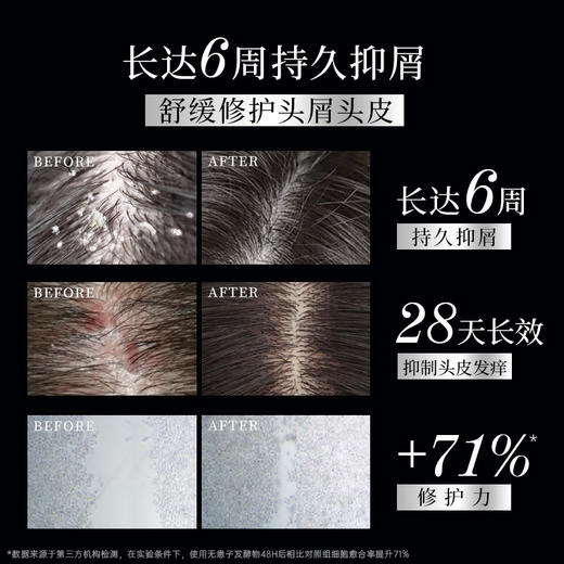 滋源丨 维稳去屑平衡洗头水 400g/瓶 商品图4
