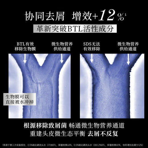 滋源丨 维稳去屑平衡洗头水 400g/瓶 商品图3