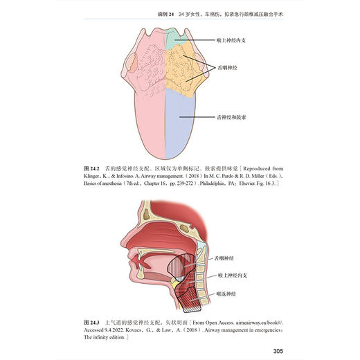 麻醉与危重症早交班 精要与拓展 高志峰 段怡 主译 高效实用 基于病例的学习用书 麻醉学住院医师培训的理想之选北京大学医学出版社 商品图4