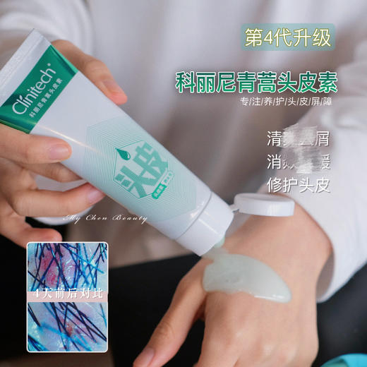 头脸一张皮｜科丽尼第四代头皮素75ml 洗发水去屑控油舒H 商品图0
