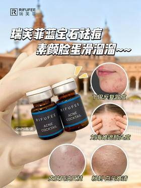 瑞芙菲蓝宝石祛痘精华5ml单支  西班牙原装淡化痘印痘坑粉刺MTS水光精华液