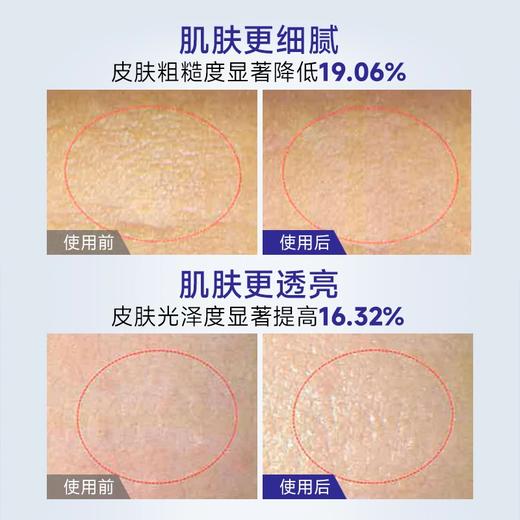 ⁴【一氪5%烟酰胺精华水】5%法国进口烟酰胺+温泉水+多种植萃 120ml/瓶 YC04-CR-YK【HOT】 商品图2