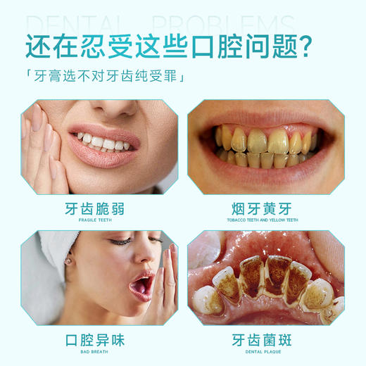 ⁴59元/2支还送小样【美白去渍牙膏】添加专利纳米级羟基磷灰石+木瓜蛋白酶 YC04-CR-YK 商品图2