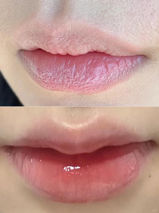 【多妈团购 迪肤特二类医疗器械 唇膏】水水润润，一点不黏腻，独有的创面修复专利+有效润护成分+无菌生产标准，解决嘴唇~~炎，唇裂，唇起皮--咸喜仓 商品图3