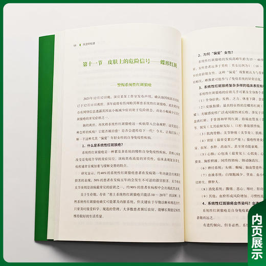 风湿早知道 刘坚 主编 教会读者警觉和辨别风湿病与肿瘤和感染之间的相互伪装 图文并茂 9787567928022 中国协和医科大学出版社 商品图3