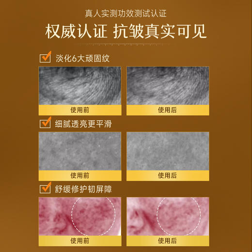 ⁴【一氪角鲨烷悦活精粹油】角鲨烷+霍霍巴油+澳洲坚果籽油+沙棘果油+依克多因+三型胶原蛋白+玻色因等 35ml/瓶 YC04-CR-YK 商品图3