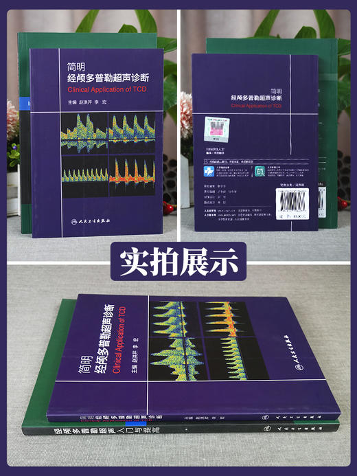 【套装2本】经颅多普勒超声入门与提高+简明经颅多普勒超声诊断 初学者规范化培训TCD操作 颅外动脉检测流程 TCD临床应用操作技术 商品图2